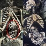 Discovery of Skeleton of Pregnant Mother and Her Unborn Child Sheds Light on Tragic Ancient Demise